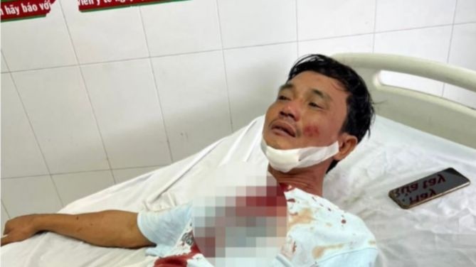 Cảnh báo văn hóa liên lạc