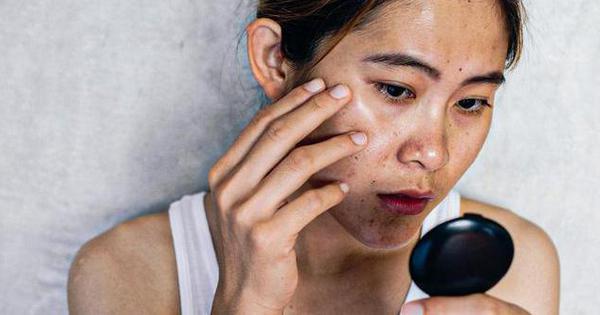 3 thói quen làm cho gia đen sạm, thậm chí lão hóa rất thời gian nhanh nhưng chị em luôn luôn chủ quan
