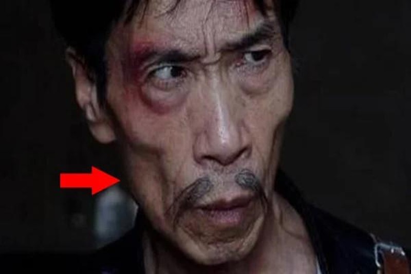 Những người với nhị má ko tồn tại thịt tuyệt đối ko nên đi lại