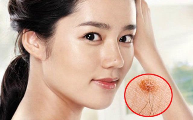 4 vị trí mọc tóc dự báo “ngồi ko hưởng lộc” chớ nhổ