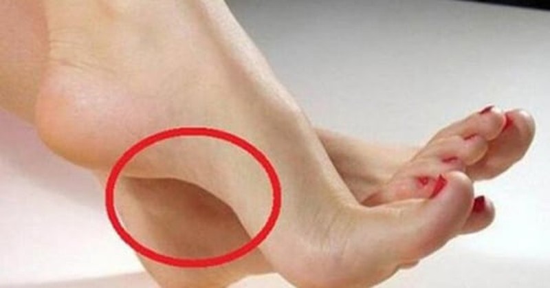 Nhìn tướng bàn chân hoàn toàn sở hữu thể biết ngay tương lai giàu nghèo.