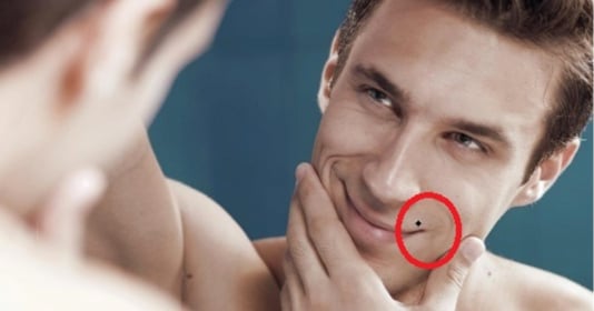 5 vị trí nốt ruồi tố cáo con trai đa tình, thích nuôi chị em nhé.