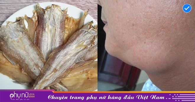 4 loại cá mang nguy cơ ‘nhiễm độc’ thủy ngân, ăn nhiều hoàn toàn mang thể gây ung thư